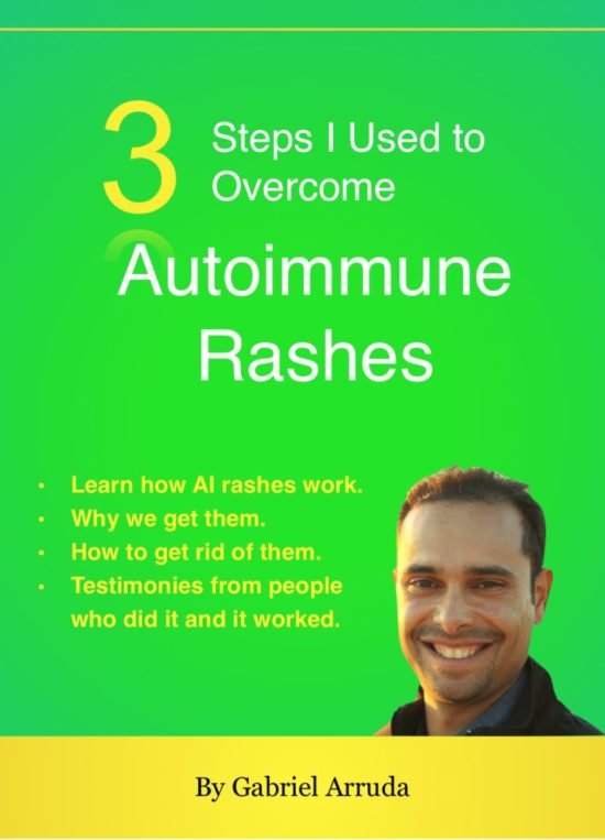 Autoimmune Rashes Cure